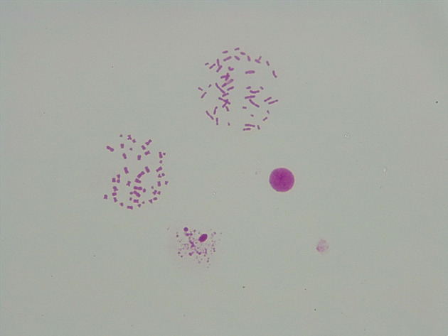 Female Chromosomes Slides - Female Chromosomes 07 400X